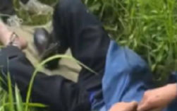 老人被五步蛇咬伤打16支血清保住脚趾！