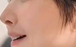 演员孙菲菲回应整容失败 ：患库欣氏综合征！