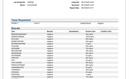 特斯拉CEO到底吸毒了没 马斯克公布尿检报告自证