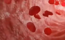 郑州女子长期压抑情绪90%血管堵死 医生提醒：心眼有多大，血管就有多粗！