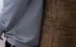 大妈撞树硬核健身差点撞瘫痪 确诊为迟发性创伤后椎体骨坏死！