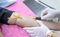 全国首个基因治疗药获批上市：注射一次可治疗中重度血友病B！