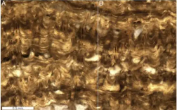 4.8亿年前“嫘祖冠毛层孔海绵”现身 背后秘密让人瞠目!