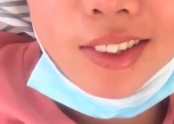 女子午休时开风扇 睡醒后面瘫 到底怎么回事？