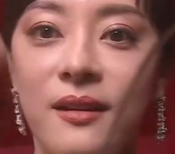 孙俪的唇下痣没了 到底啥情况